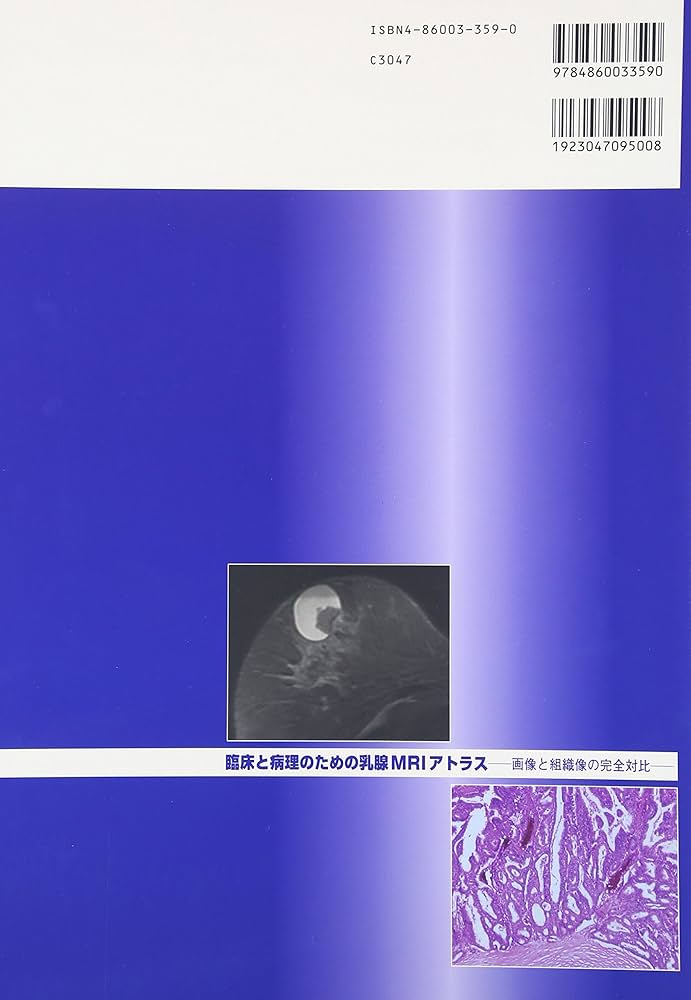 ▲01)【同梱不可】臨床と病理のための乳腺MRIアトラス/画像と組織像の完全対比/土屋眞一/医療科学社/2006年/A 臨床と病理のための乳腺MRIアトラス | 眞一, 土屋, 達夫, 隈崎